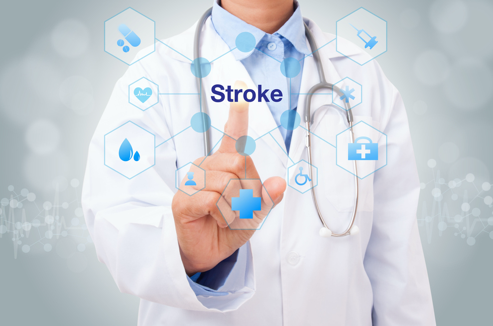 What Is A TIA Stroke Find Neurologists Near Me